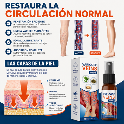 Varicose VEINS™ Spray
