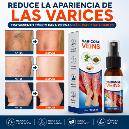 Varicose VEINS™ Spray